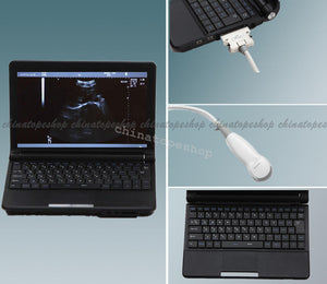 igital Laptop Notebook ultrasound scanner machine +Micro Convex probes Sale