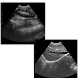Laptop Machine HandScan Ultrasound scanner Convex +Linear+ Cardiac Heart 3 Probe 190891048707