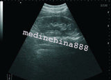 New 10.1'' Ultrasound Scanner With Convex+Linear+Transvaginal+Micro-convex Probe