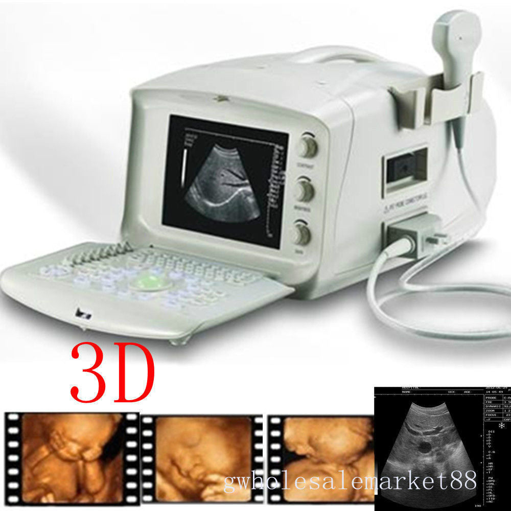 Portable Machine Digital Ultrasound Scanner Transvaginal Probe 3D Software Gift 190891982230 DIAGNOSTIC ULTRASOUND MACHINES FOR SALE