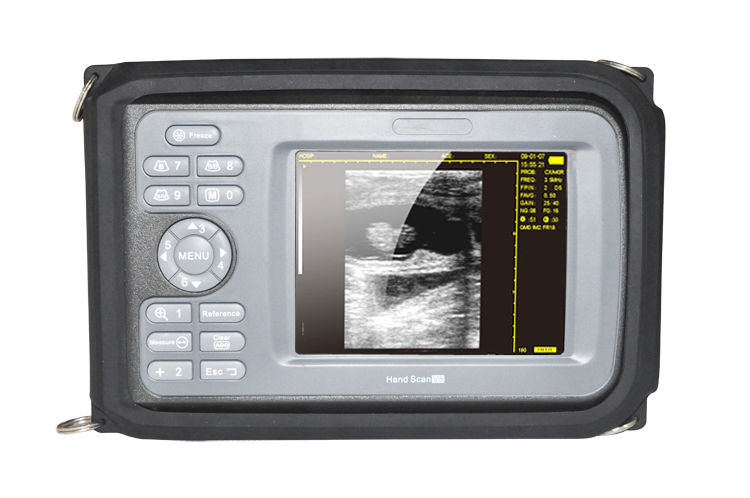 Medical Veterinary Mini Digital PalmSmart Ultrasound Scanner with Rectal Probe DIAGNOSTIC ULTRASOUND MACHINES FOR SALE