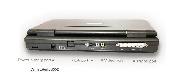 Portable laptop machine Digital Ultrasound scanner Convex/Linear/Cardiac 3 Probe DIAGNOSTIC ULTRASOUND MACHINES FOR SALE
