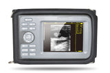 Medical Handheld Digital Ultrasound Scanner Machine Linear Probe+ US PR Oximeter 190891041111