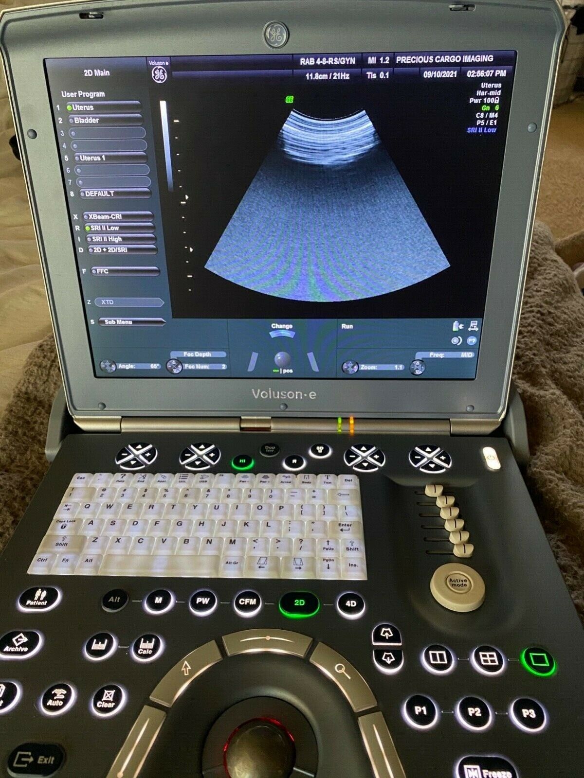 GE Voluson E Portable Ultrasound Machine with 3D4D Probe  DIAGNOSTIC ULTRASOUND MACHINES FOR SALE