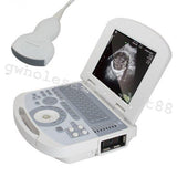 USA! Clear Digital Laptop Medical Ultrasound Scanner Machine Convex Probe 3D 190891422491