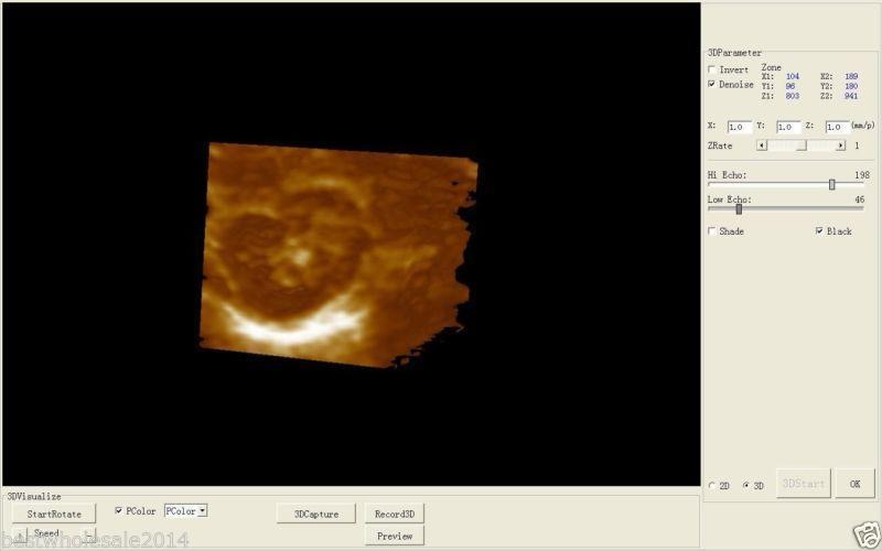 Laptop Ultrasound Scanner Machine Convex Linear 2 Probes Scanning Machine *3D* DIAGNOSTIC ULTRASOUND MACHINES FOR SALE