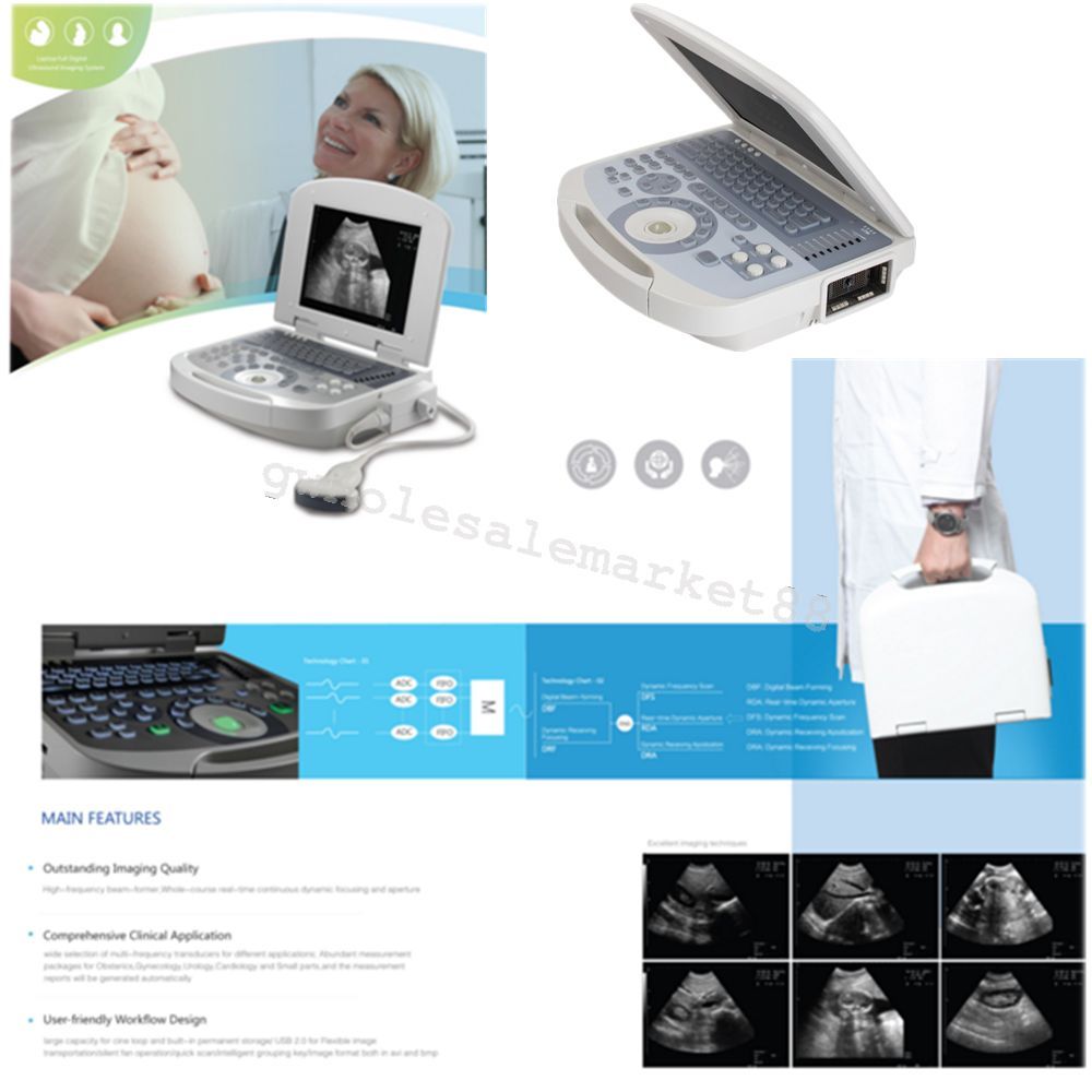 USA Top Resolution Laptop Medical Ultrasound Machine Scanner Convex probe Image 190891422491 DIAGNOSTIC ULTRASOUND MACHINES FOR SALE