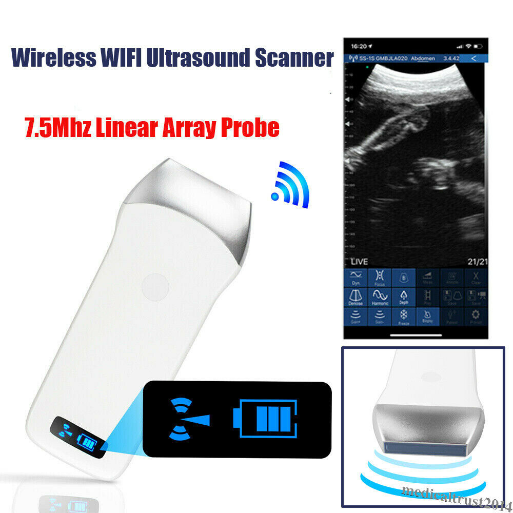 Portable Human Mini WIFI Wireless Ultrasound Scanner Machine Linear Probe 7.5Mhz DIAGNOSTIC ULTRASOUND MACHINES FOR SALE
