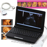 Digital Ultrasonic Ultrasound Scanner +Convex Vignal &Linear 3 Probe Fee 3D Sale 190891823137