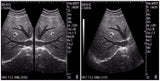 Portable Ultrasound Ultrasound Scanner Convex Linear Transvaginal 3 Probes 3D A+ 190891445834