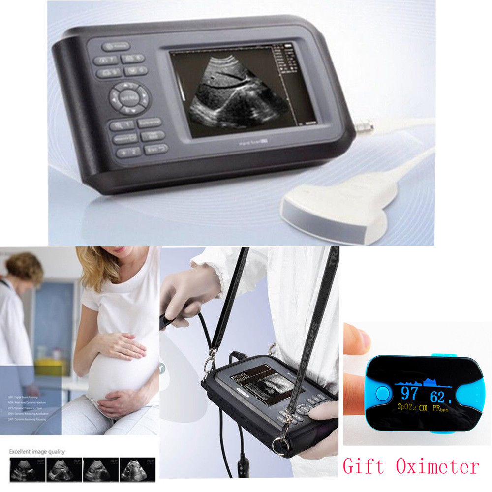 Handheld Ultrasound Scanner Machine Convex Probe+Pulse Oximeter + Battery + Case DIAGNOSTIC ULTRASOUND MACHINES FOR SALE