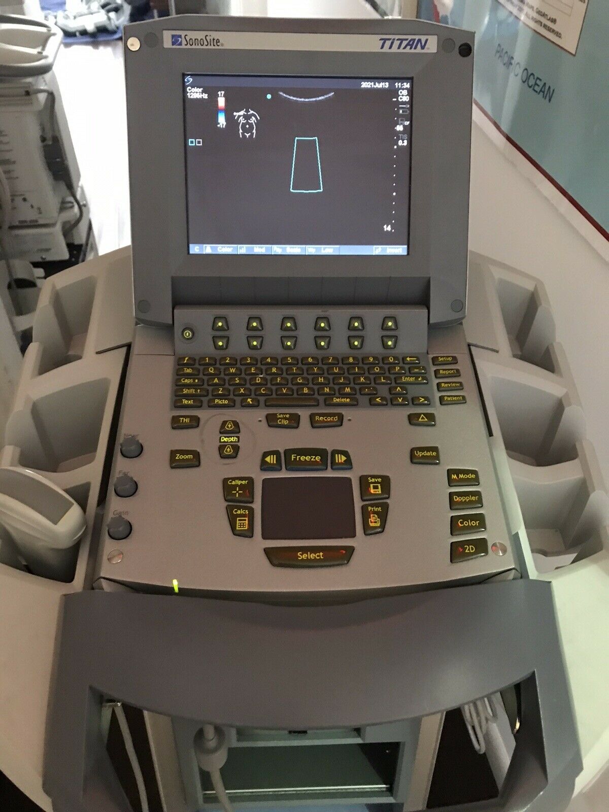 Sonosite Titan High Resolution Ultrasound P04240-12 DIAGNOSTIC ULTRASOUND MACHINES FOR SALE