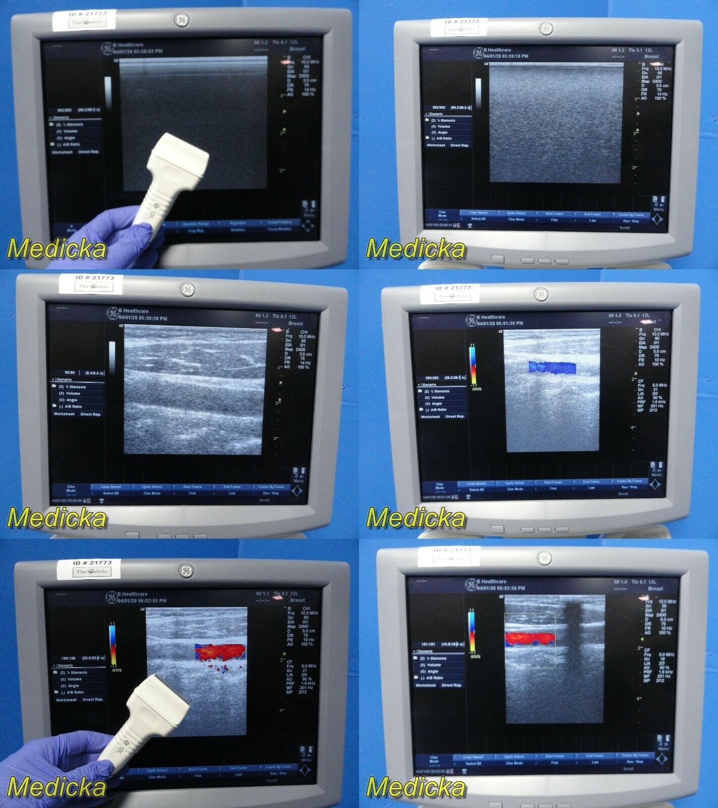 2008 GE LogiQ P5 Flat-Screen Ultrasound W/ 4C & 12L Transducers / Probes ~ 21773 DIAGNOSTIC ULTRASOUND MACHINES FOR SALE