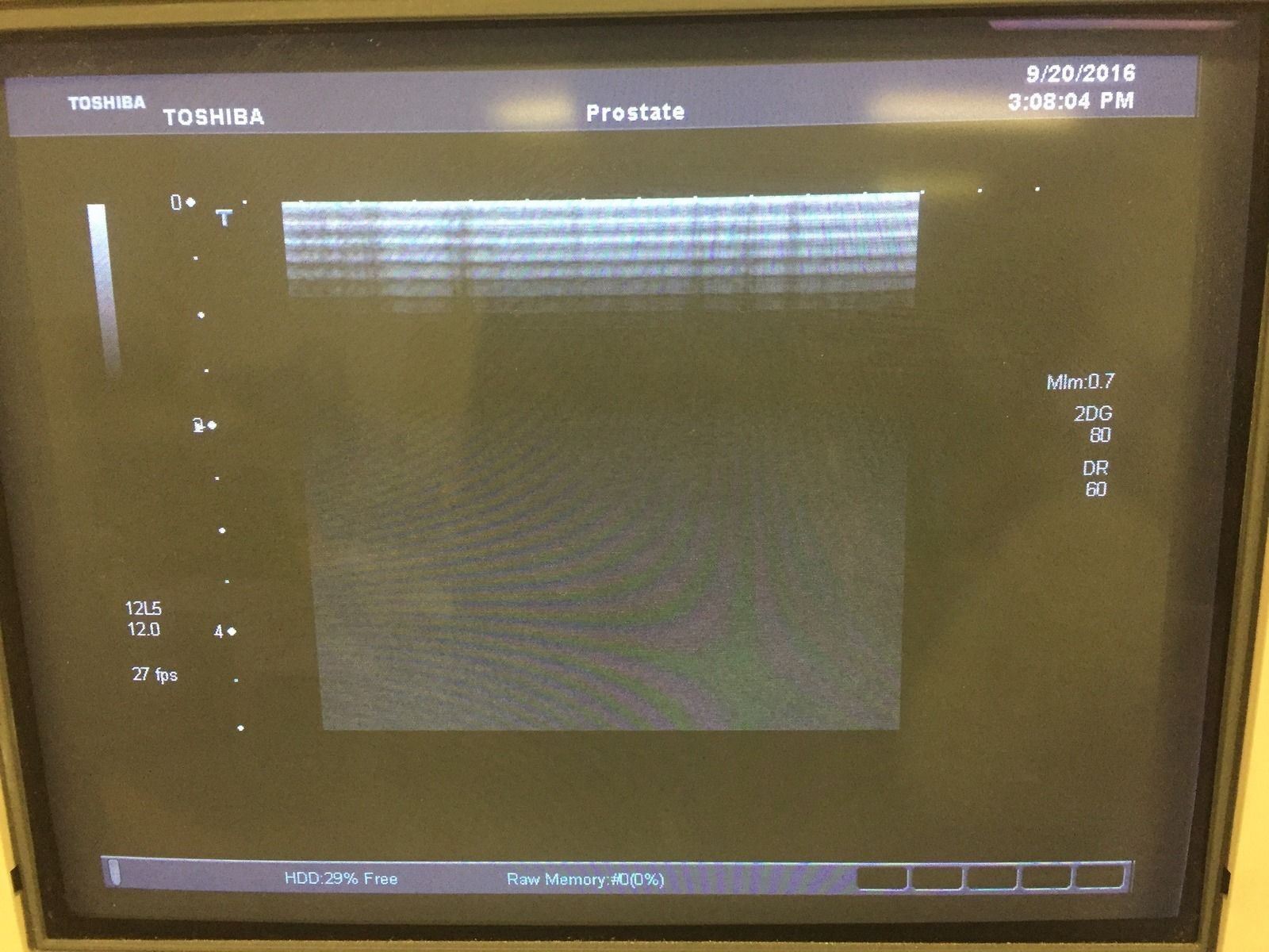 Toshiba Aplio 500 PLT-805AT 8 MHz Linear Transducer Probe for Small Parts DIAGNOSTIC ULTRASOUND MACHINES FOR SALE