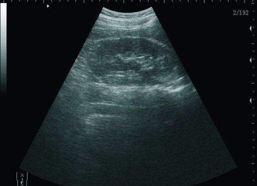 Laptop Ultrasound scanner Transvaginal probe/Sensors +3D Ultrasonic Machine AA 190891521613 DIAGNOSTIC ULTRASOUND MACHINES FOR SALE