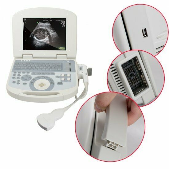 10.4inch Portable Digital Medical Laptop Ultrasound Scanner Machine+Convex probe DIAGNOSTIC ULTRASOUND MACHINES FOR SALE