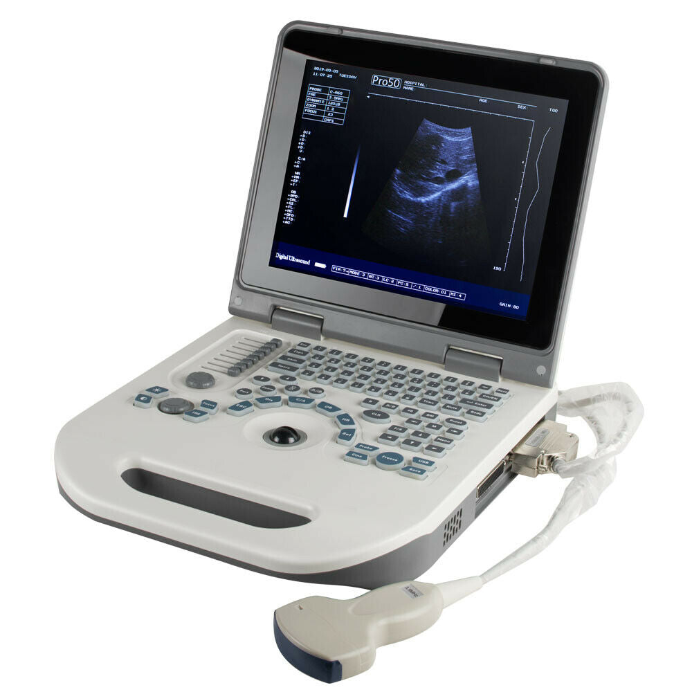 Portable Ultrasound Scanner Laptop Machine Safty Ultrasonic System+Convex Probe DIAGNOSTIC ULTRASOUND MACHINES FOR SALE