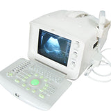 Digital Ultrasound Scanner Micro-Convex Probe  Ultrasonic Machine 3D Sonogram CE