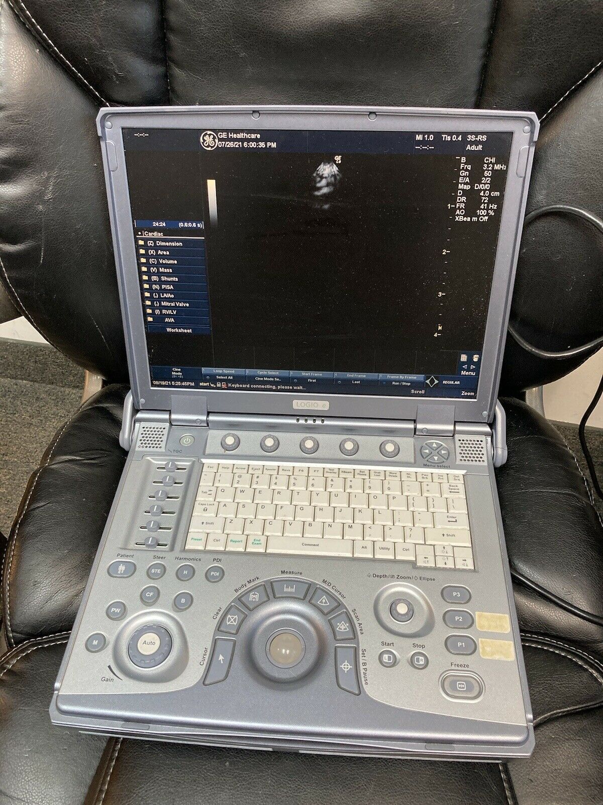 GE Logiq E portable ultrasound model 5199704/5122757 DIAGNOSTIC ULTRASOUND MACHINES FOR SALE