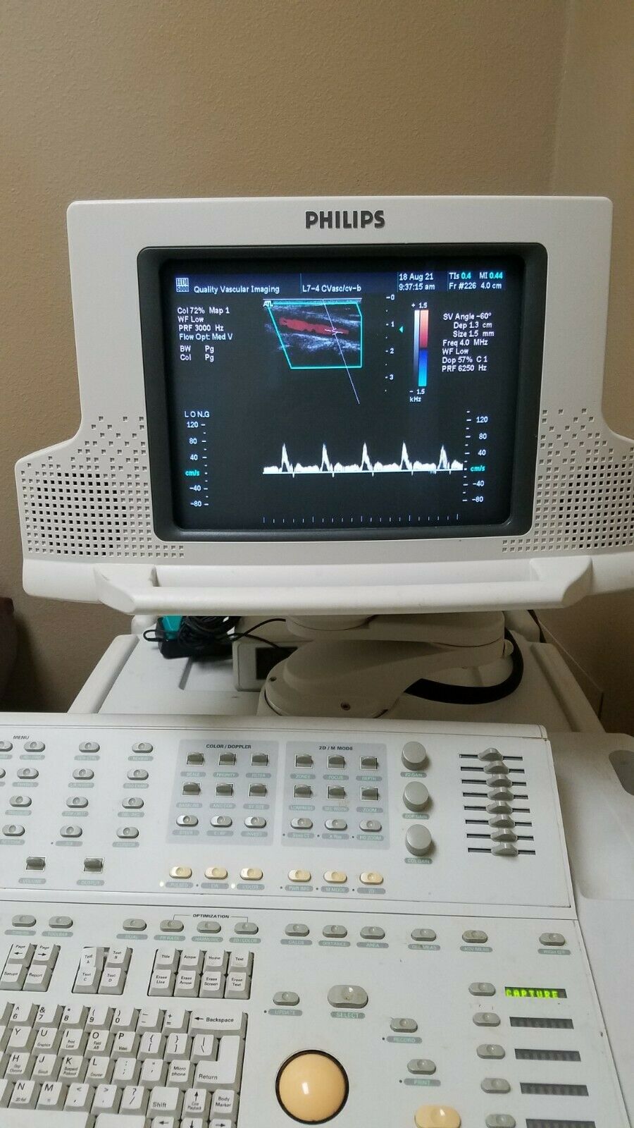 Phillips HDI 5000 Ultrasound Instrument DIAGNOSTIC ULTRASOUND MACHINES FOR SALE