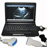 Full Digital Laptop Ultrasound Scanner 2 Probes Covex + Linear Probes 3D Precise 190891802569