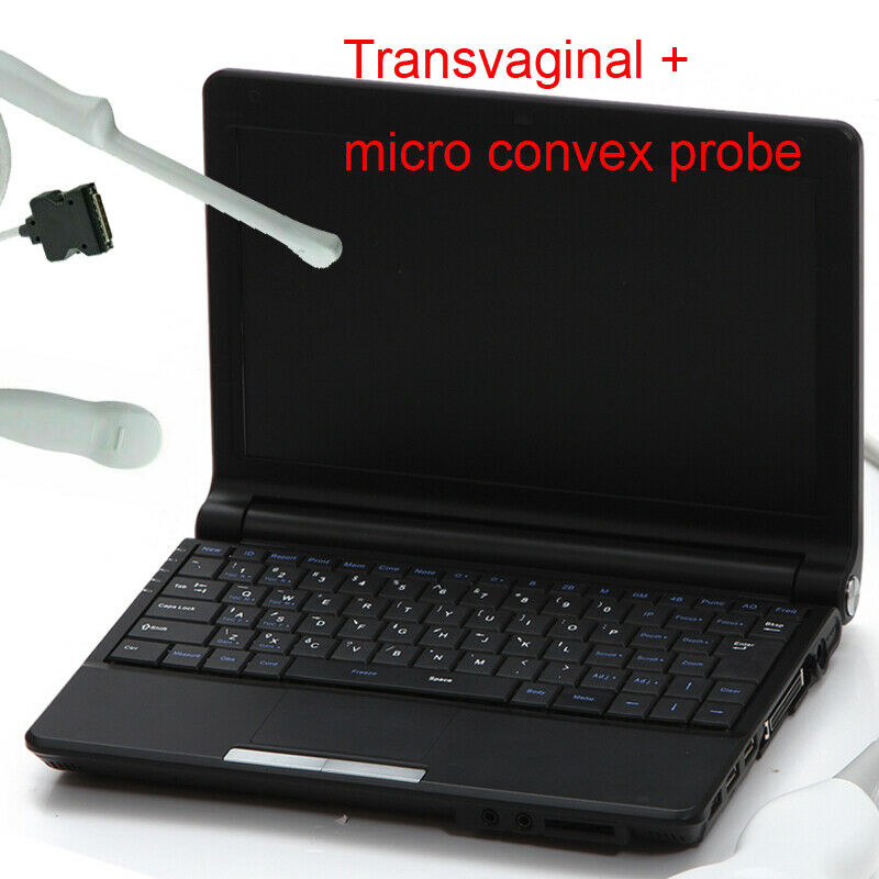 Portable Laptop Ultrasound Scanner Machine Transvaginal + Micro Convex Probes DIAGNOSTIC ULTRASOUND MACHINES FOR SALE