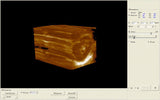 Update Portable Ultrasound Scanner Machine system with Linear Probe +3D Software 190891287816