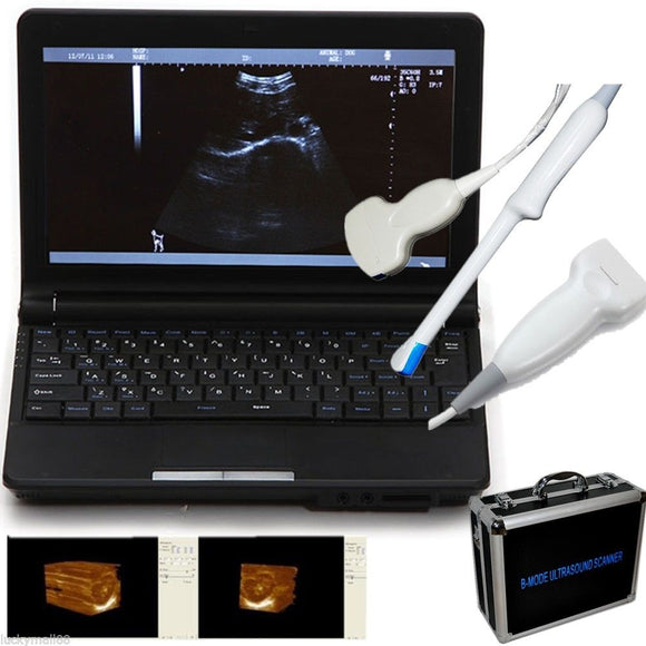 Ultrasound Scanner Machine System Convex Linear Transvaginal 3 Probe + Case Kit 190891046307