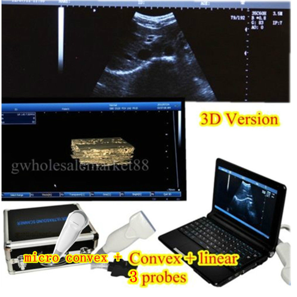 Laptop Ultrasound Scanner Machine Convex+micro convex Heart Pr+Linear 3D 3 Probe 190891055842 DIAGNOSTIC ULTRASOUND MACHINES FOR SALE