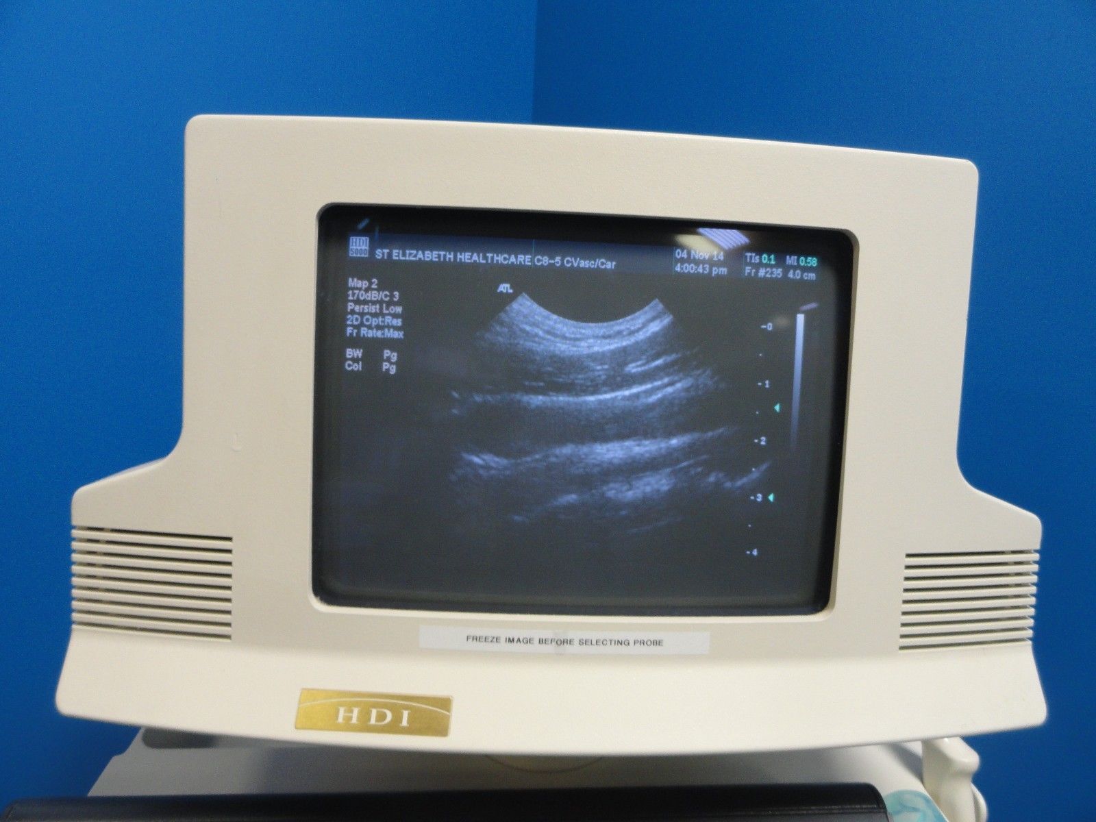 ATL C8-5 14R Micro-Convex Small Parts CVS PVS MSK Peads & OB Probe (8263) DIAGNOSTIC ULTRASOUND MACHINES FOR SALE