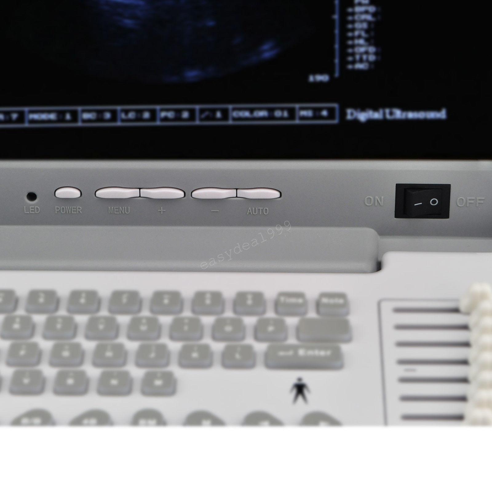 Full Digital Portable Ultrasound Scanner Machine Convex Transvaginal 2 Probes 3D 190891678171 DIAGNOSTIC ULTRASOUND MACHINES FOR SALE