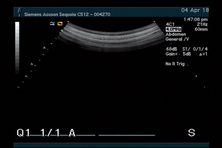 ACUSON 4C1 ULTRASOUND PROBE. REFURBISHED. WORKS FINE DIAGNOSTIC ULTRASOUND MACHINES FOR SALE