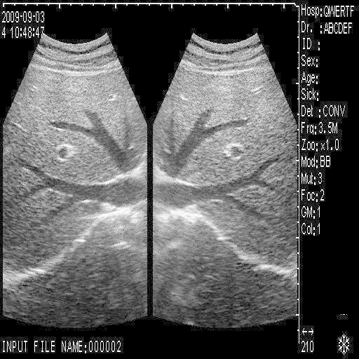New +3D Digital Ultrasound Scanner +Convex Transvaginal probes 2 probes Set Sale 190891051066 DIAGNOSTIC ULTRASOUND MACHINES FOR SALE