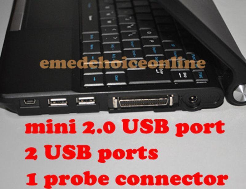 External 3D Software Medical Digital Laptop Ultrasound Scanner Scan Linear Probe 190891735522 DIAGNOSTIC ULTRASOUND MACHINES FOR SALE