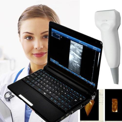 Laptop Ultrasound machine Scanner system 7.5Mhz High Frequecy Linear Probe+3D A+