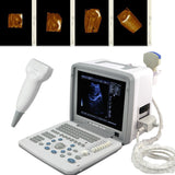 Portable 12'' SVGA LCD Digital Ultrasound Scanner System Convex Linear Probes 3D 190891802217