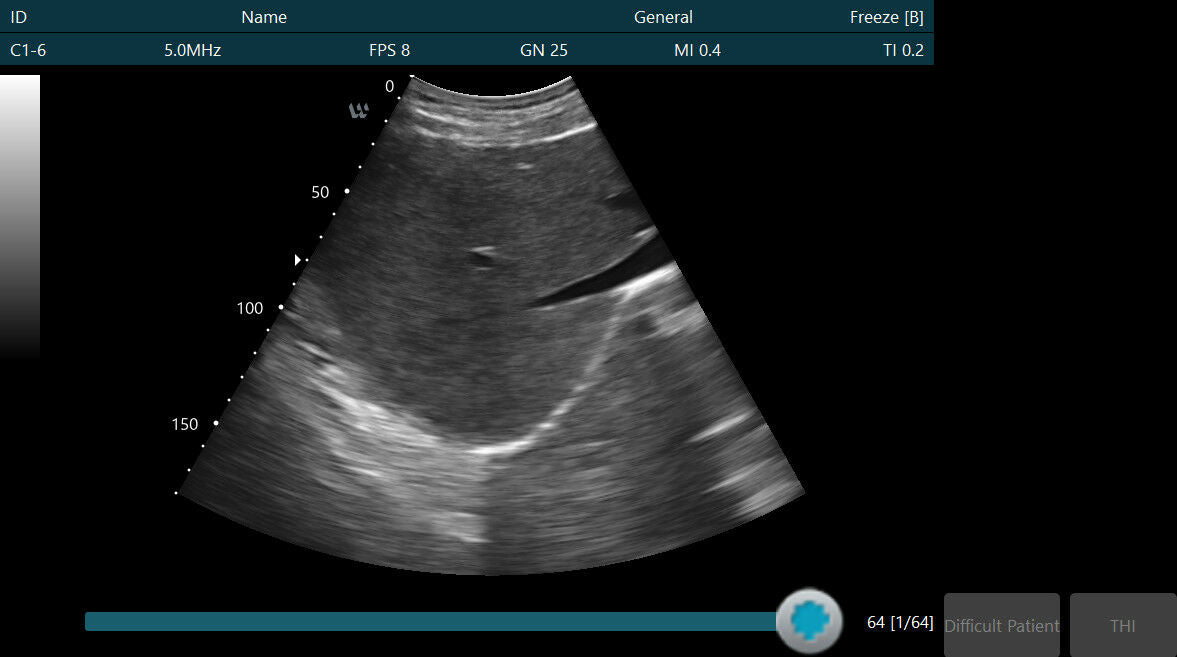 NEW Handheld Veterinary Ultrasound Scanner (probe only) DIAGNOSTIC ULTRASOUND MACHINES FOR SALE