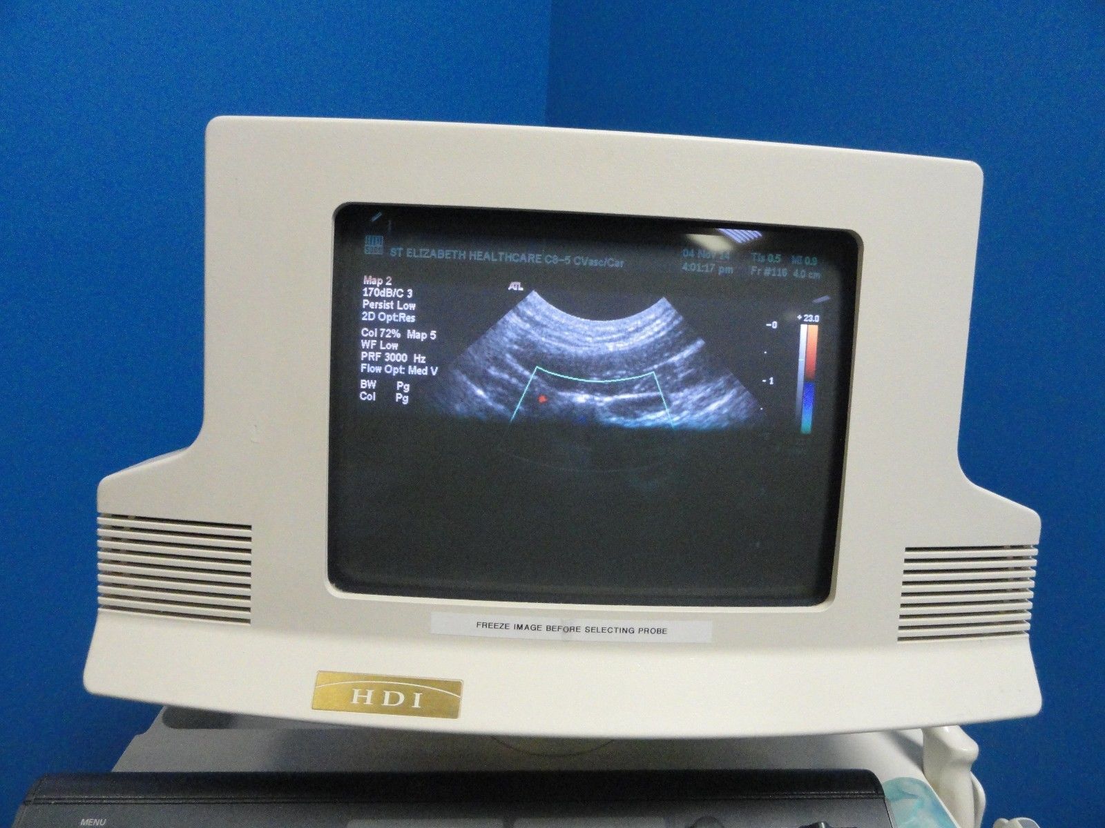 ATL C8-5 14R Micro-Convex Small Parts CVS PVS MSK Peads & OB Probe (8263) DIAGNOSTIC ULTRASOUND MACHINES FOR SALE