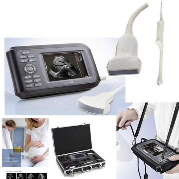 Portable laptop Machine Ultrasound Scanner Convex +Linear +Transvaginal 3 Probe