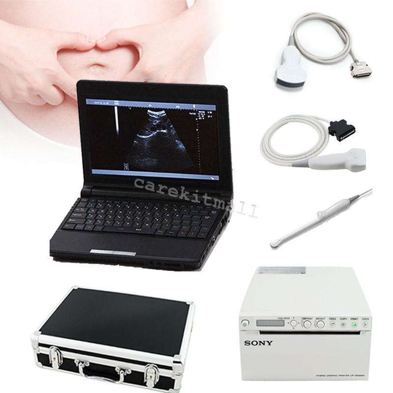 10.1'' Ultrasound Scanner+Convex,Linear,Transvaginal,Probe with thermal recorder DIAGNOSTIC ULTRASOUND MACHINES FOR SALE