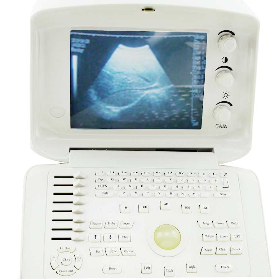 Farm Animal Ultrasound Scanner 10.1'' LCD Machine with Convex ,Linear Probe,+3D 190891975683 DIAGNOSTIC ULTRASOUND MACHINES FOR SALE