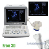 Professional  Full Digital Portable Ultrasound Scanner Convex Linear 2Probes 3D 190891754998