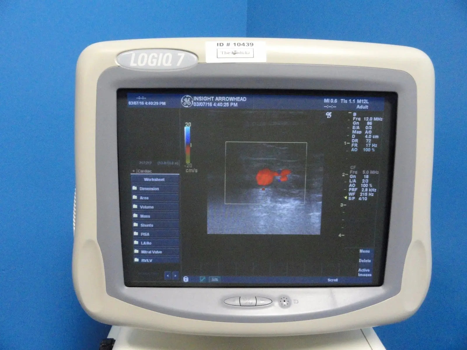 2004 GE Logiq 7 Ultrasound System W/ M12L, 3.5C Probes & B/W Printer (10439) DIAGNOSTIC ULTRASOUND MACHINES FOR SALE