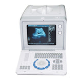 Portable LCD Digital Ultrasound Machine Covex/ Linear/ Transvaginal 3 Probes 3D 190891914545