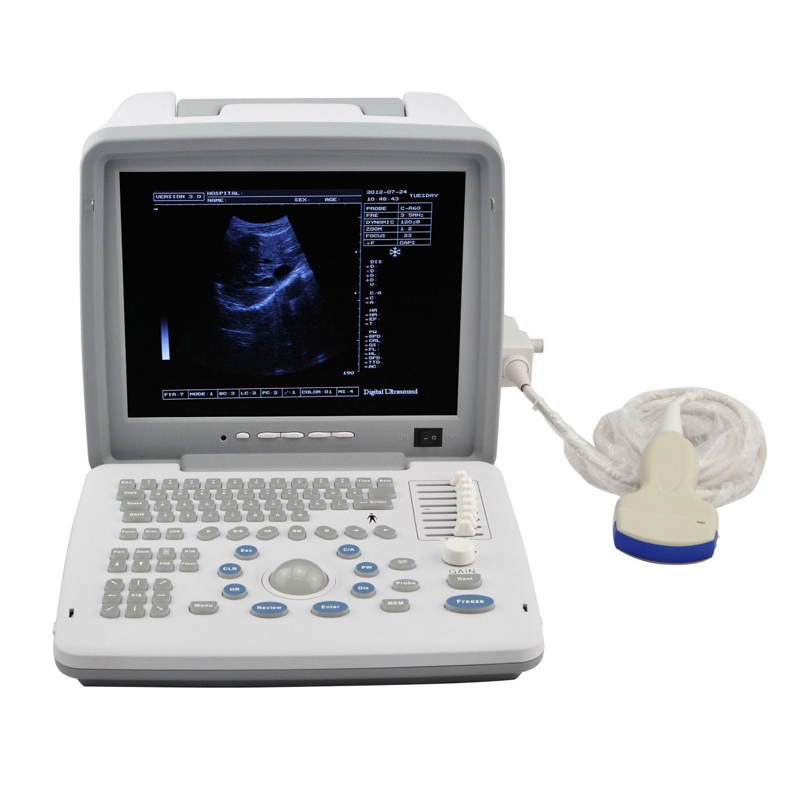 12-Inch Carejoy Digital Ultrasound Scanner Device Convex Transvaginal 2 Probes DIAGNOSTIC ULTRASOUND MACHINES FOR SALE