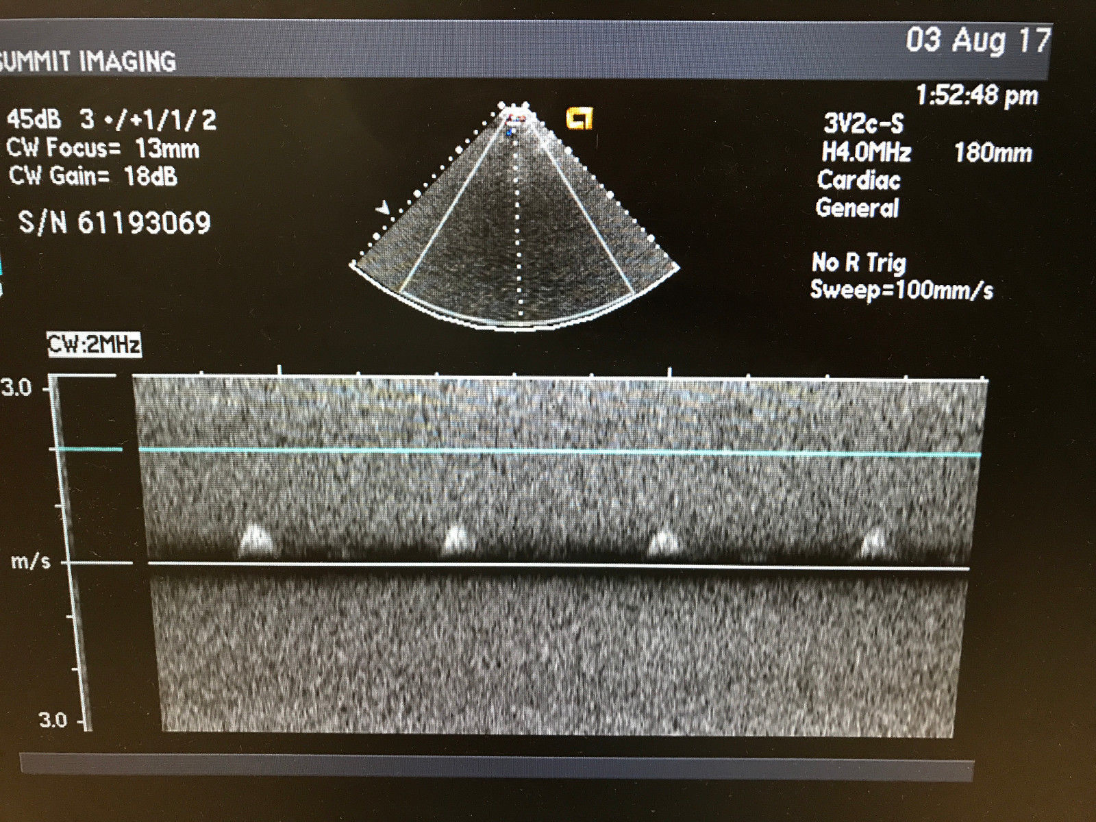 2008 Acuson 3V2c Ultrasound Transducer Probe 08260628 DIAGNOSTIC ULTRASOUND MACHINES FOR SALE