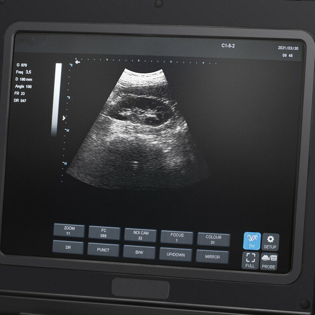 Portable 12 inch Digital Ultrasound Scanner Diagnostic Heart Rate System 3.5MHz DIAGNOSTIC ULTRASOUND MACHINES FOR SALE