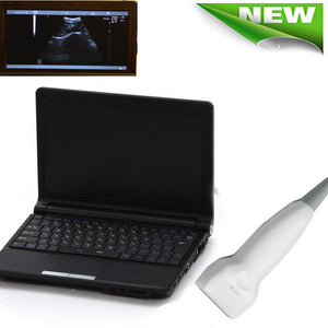 Digital Laptop Ultrasound Scanner machine system 7.5MHZ Linear Sensor/Probe+3D