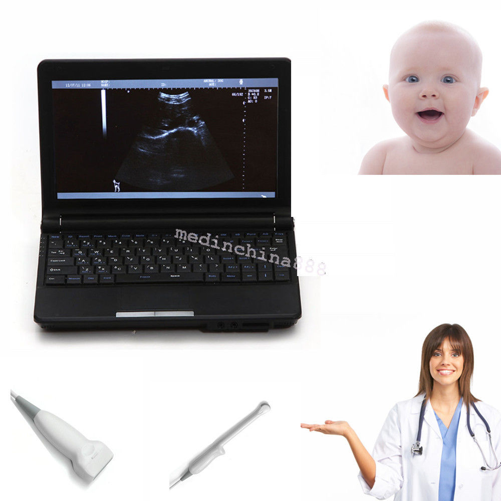 10.1'' Ultrasound Scanner Monitor Machine + Transvaginal N Linear Probes Fast DIAGNOSTIC ULTRASOUND MACHINES FOR SALE