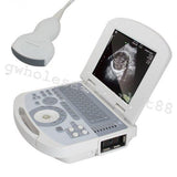 US Portable Digital Laptop Medical Ultrasound Scanner Machine Convex Probe 3D CE 190891422491